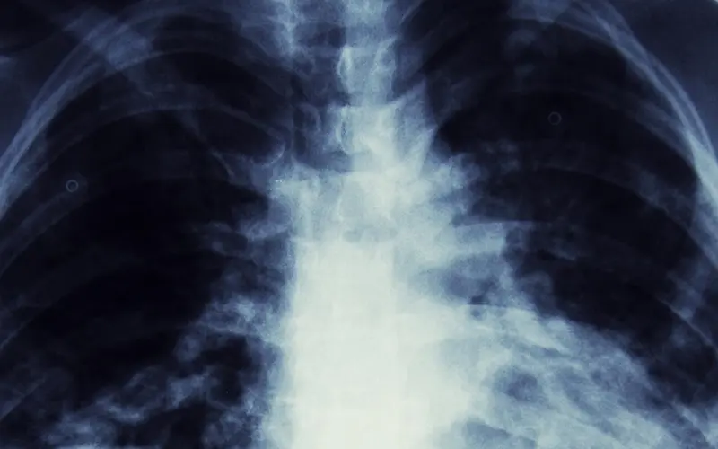 RX con contraste, rayos x, Jesús María, Lima (Perú)